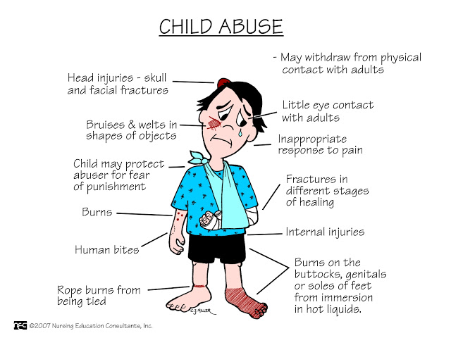 signs-symptoms-of-child-abuse